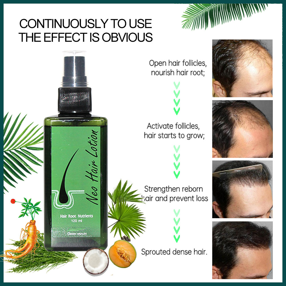 โลชั่นบำรุงผม Neo Hair Lotion  - Nutrition And Fitness บทวิจารณ์และราคา